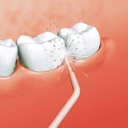 Portable Power Floss Teeth Whitening Floss (ST-101)