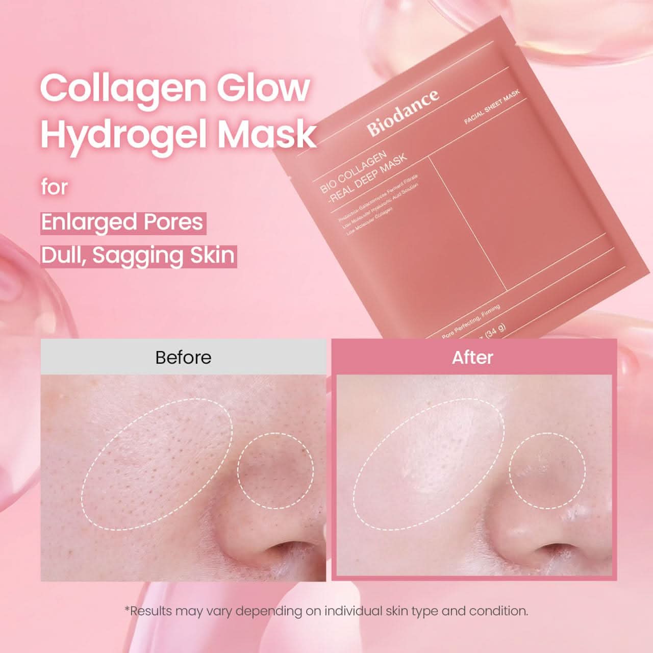 BIODANCE Bio-Collagen Real Deep Mask, Hydrating Overnight Hydrogel Face Mask, Pore Minimizing, Elasticity, Plumping, Travel Essentials & Self Care Gifts for Women, Korean Skin Care - 34g x 4Pcs