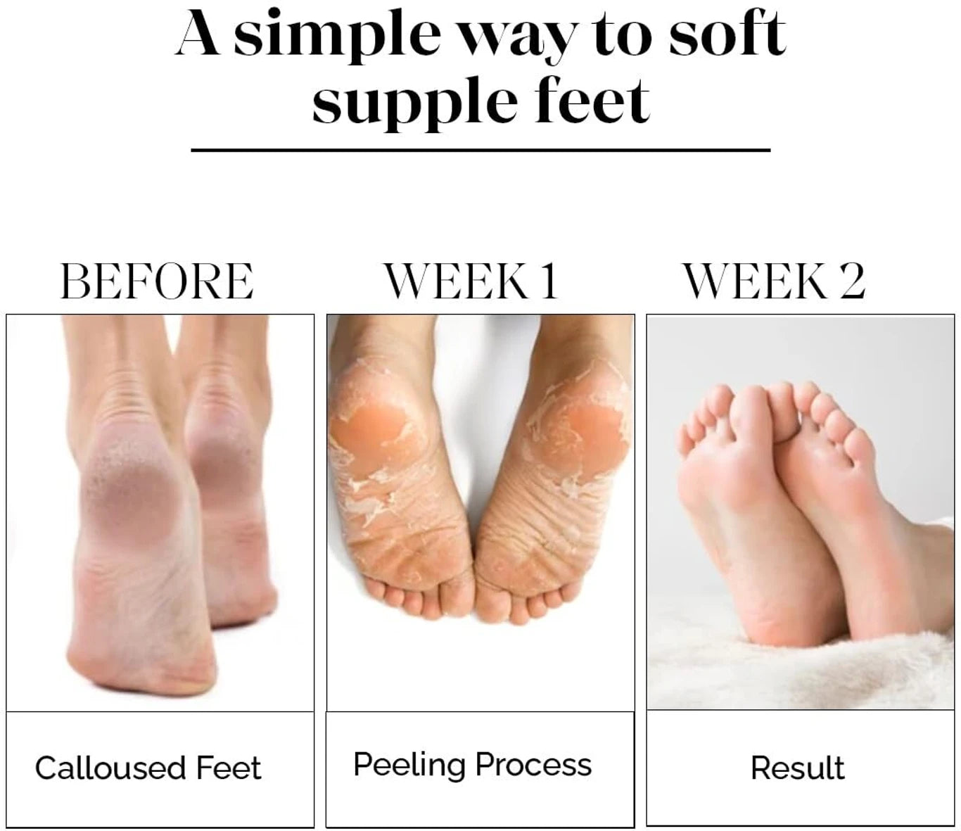 Foot Mask for Dry Cracked Feet, Foot Peel Mask for Dead Skin Removal, Moisturizing & Exfoliating Foot Mask Socks pack 1