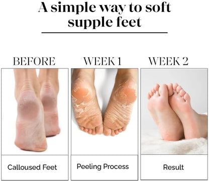 Foot Mask for Dry Cracked Feet, Foot Peel Mask for Dead Skin Removal, Moisturizing & Exfoliating Foot Mask Socks pack 1